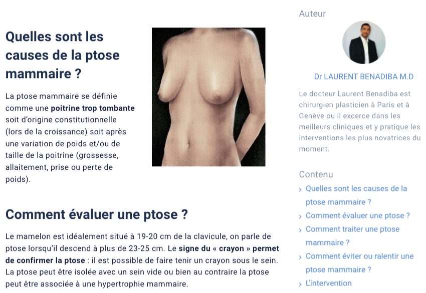 Article sur un portail éducatif sur ptôse mammaire écrit Laurent Benadiba