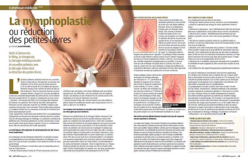 Article sur La nymphoplastie par Dr Laurent Benadiba