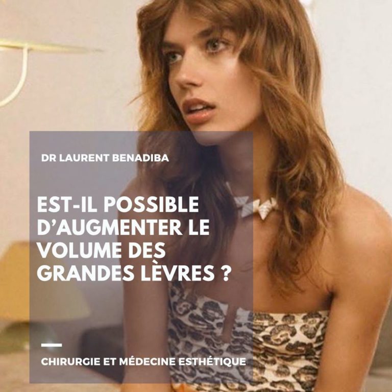 ESTIL POSSIBLE D’AUGMENTER LE VOLUME DES GRANDES LÈVRES ? Chirurgie & Médecine Esthétique à